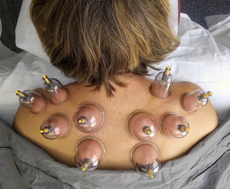 Cupping Session Only