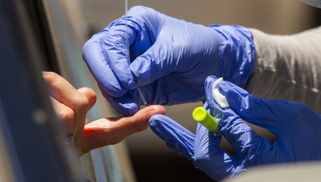 CDC: Οδηγίες για τη σωστή εκτίμηση των αποτελεσμάτων από τα τεστ αντισωμάτων