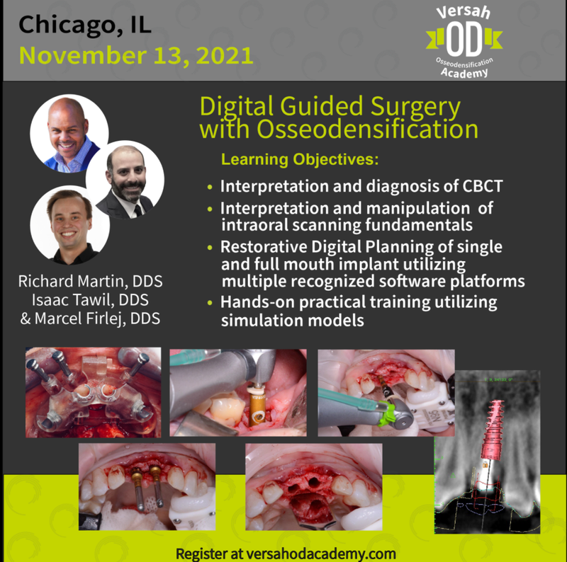 Digital Guided Surgery with Osseodensification