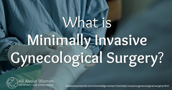 What is Minimally Invasive Gynecologic Surgery (MIGS)-