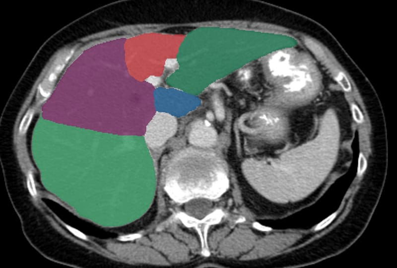 Segments liver Couinaud classification