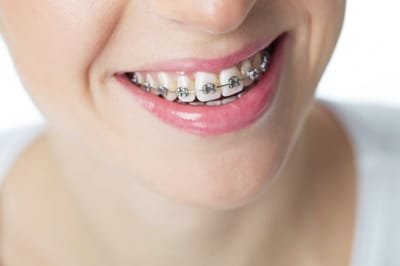 Orthodontic Treatments image