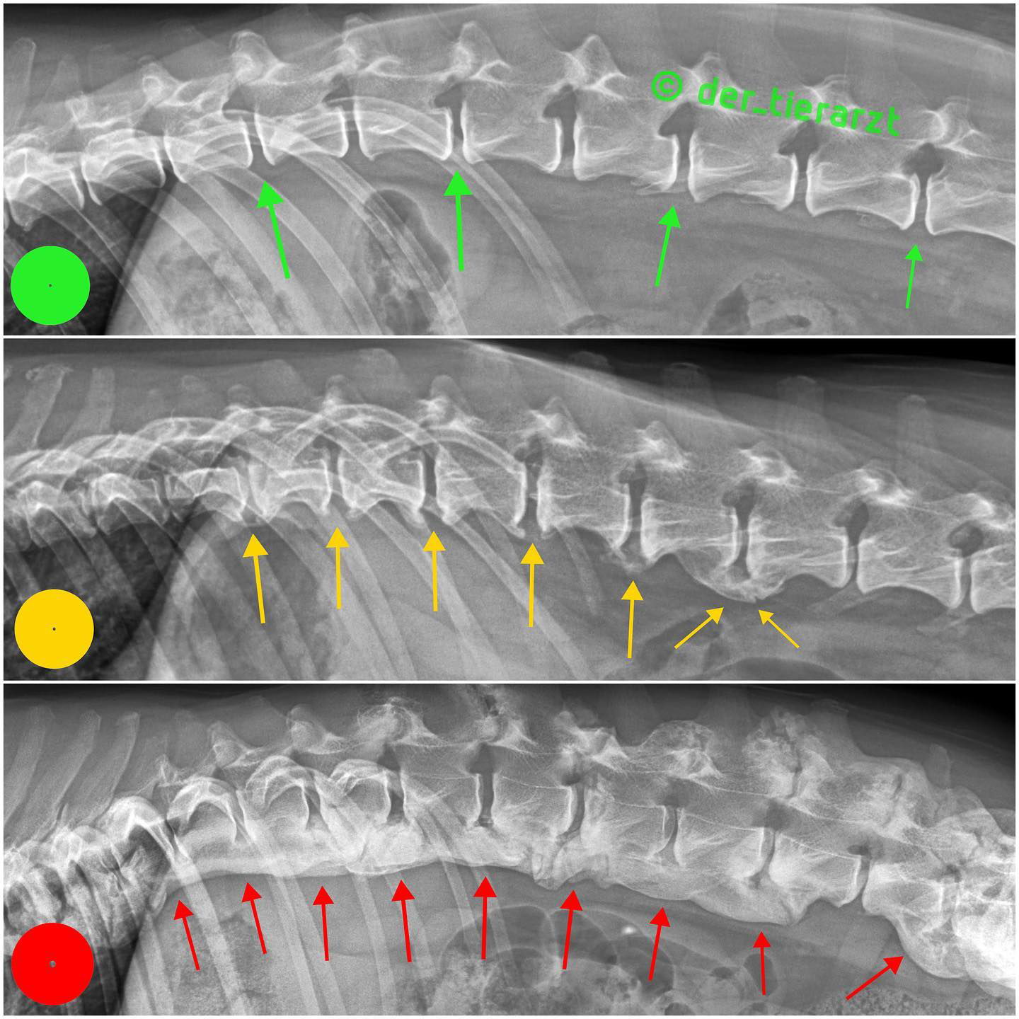 SPONDYLOSIS