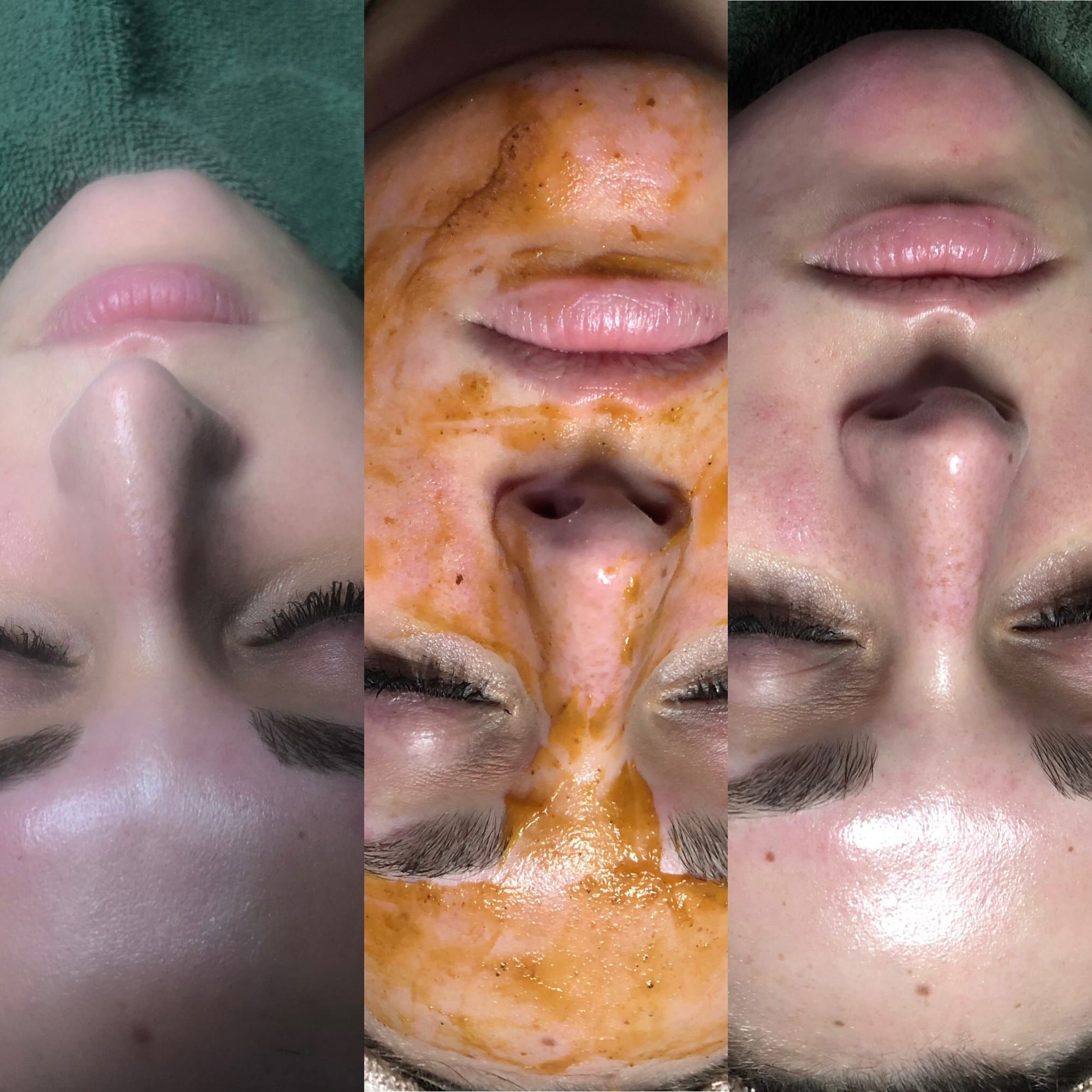 Pumpkin Facial