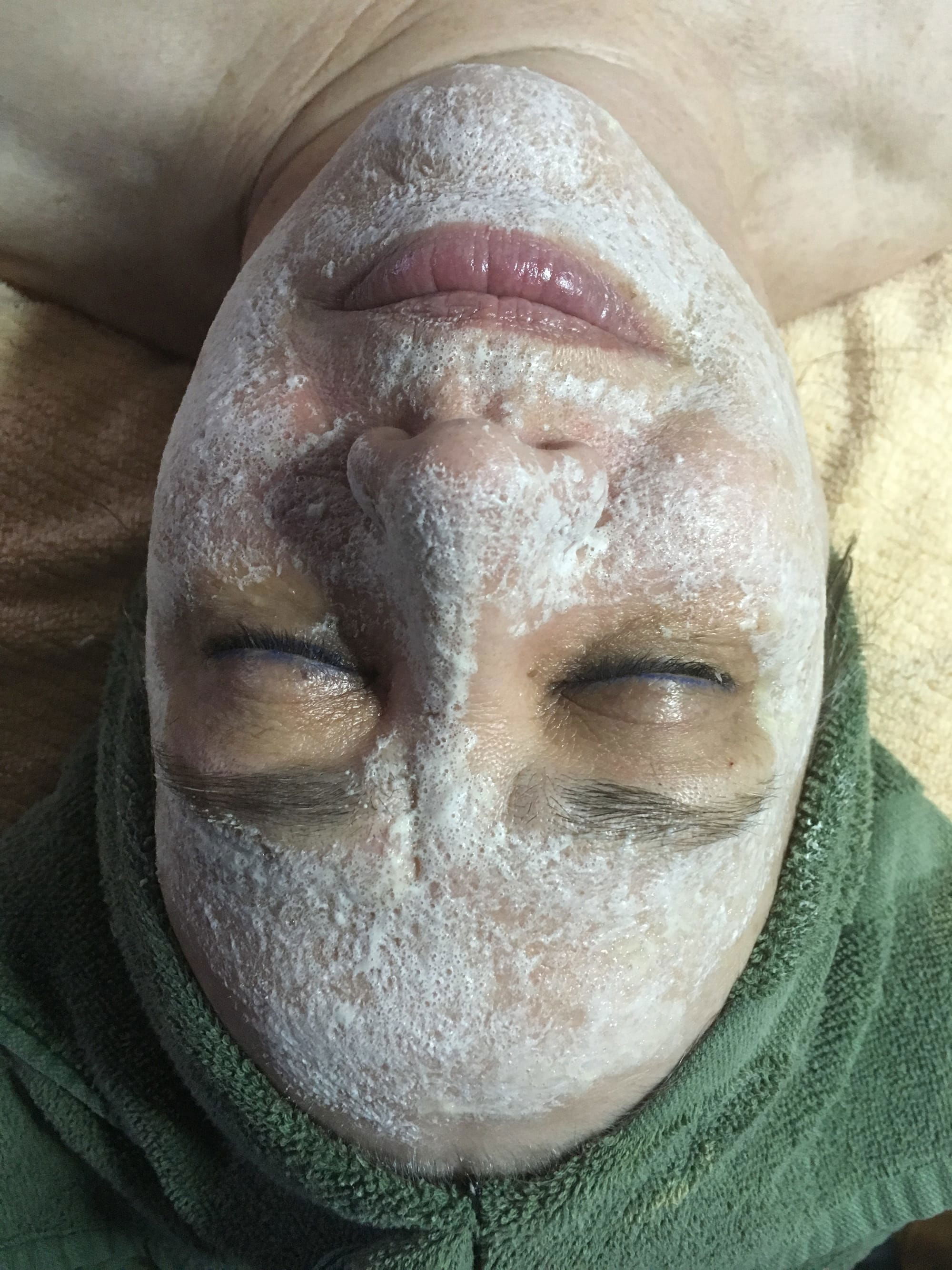 Oxygen Facial