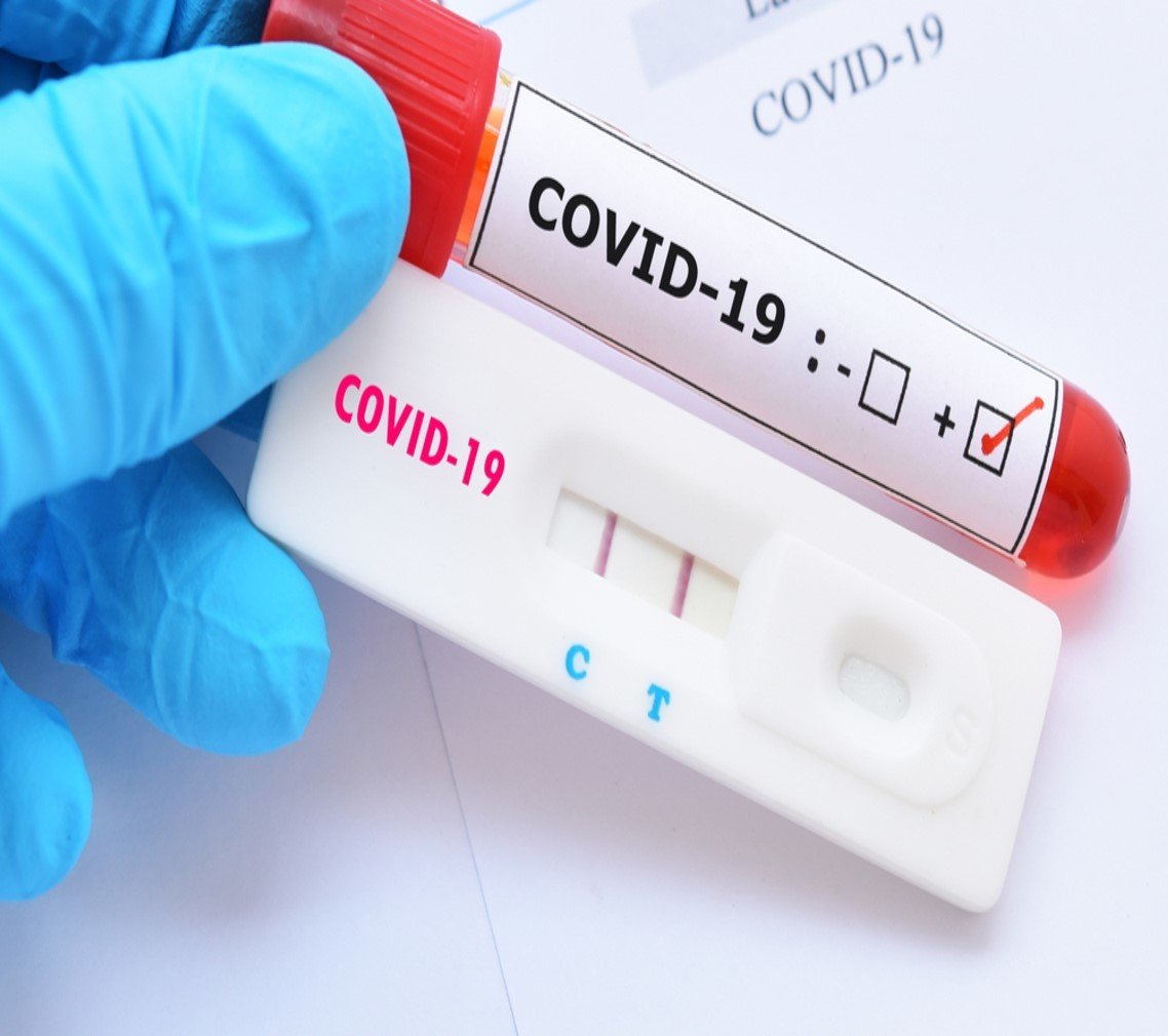 Testes rápidos de Covid e PCR