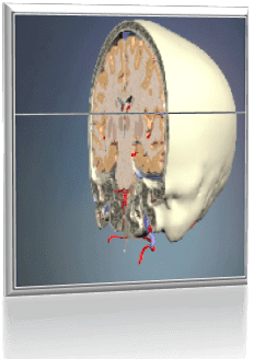 Introducing NLS 3D Scanning