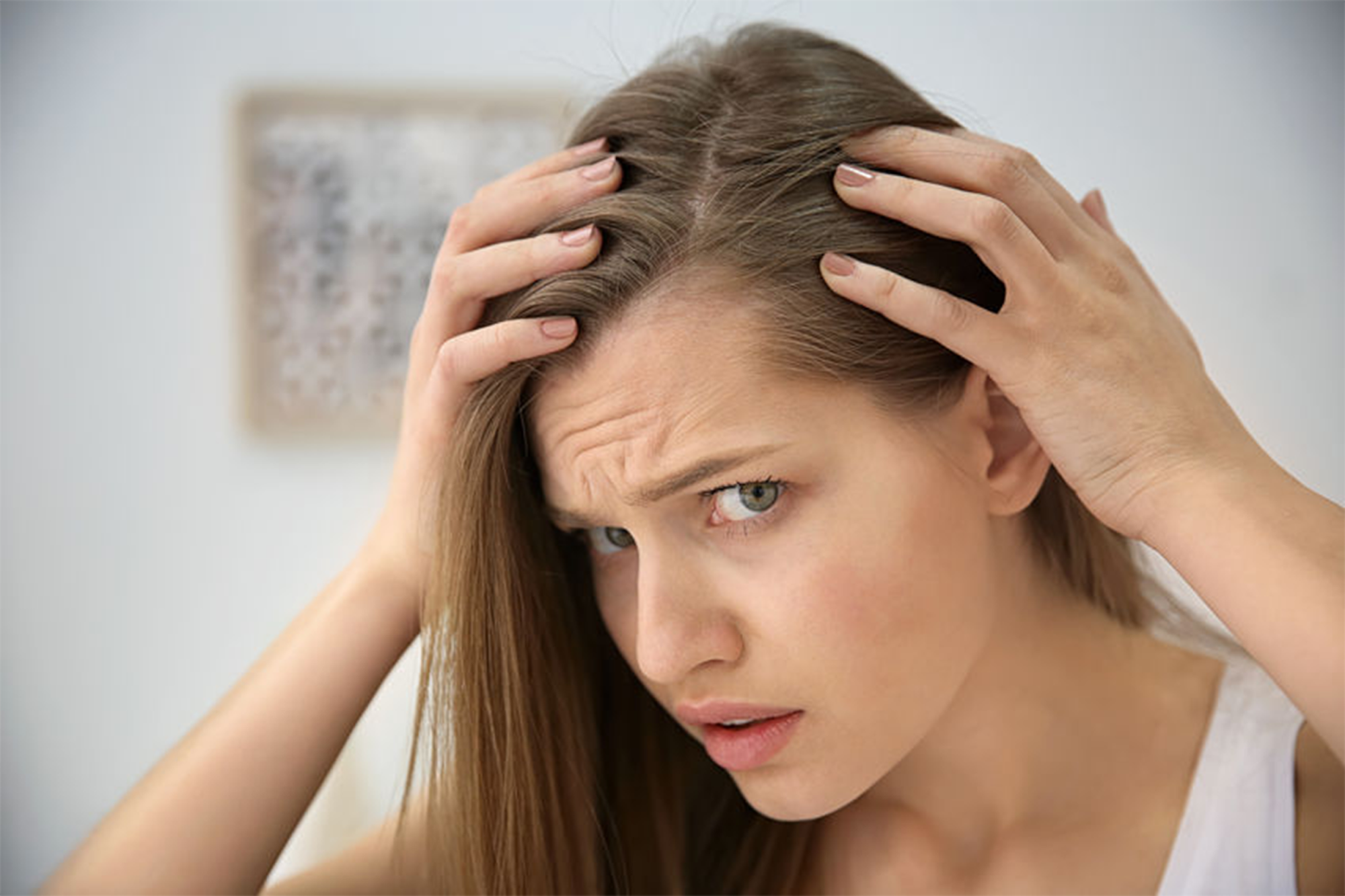 تساقط الشعر أحد الأعراض الهامة للإصابة بـ"كوفيد - 19"
