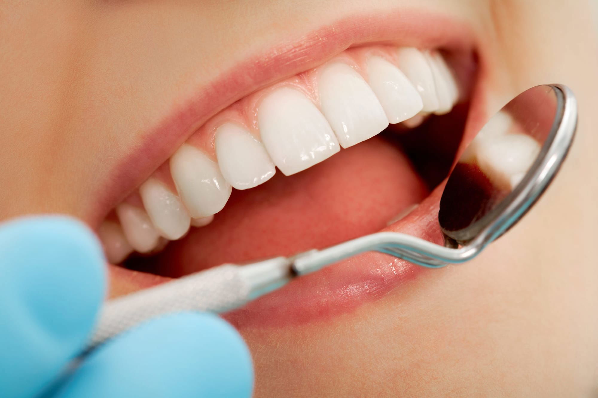 نظافة الفم البسيطة قد تقلل من احتمالية وصول SARS-CoV-2 إلى الرئتين ومن شدة "كوفيد-19"