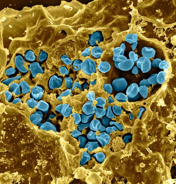 بكتريا francisella tularensis المسبب لمرض تولاريميا Tularemia ( طاعون الارانب) :