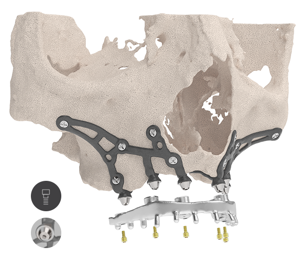 Inteligentny implant IUXTA3d