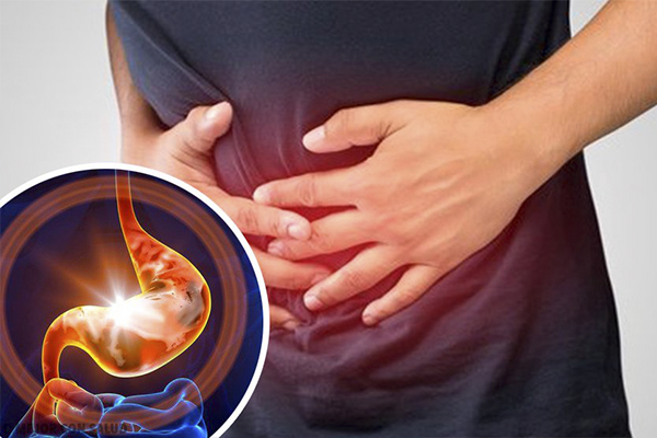 Gastritis y úlceras gástricas