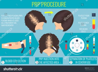 Terapie PRP - estetica medicala image