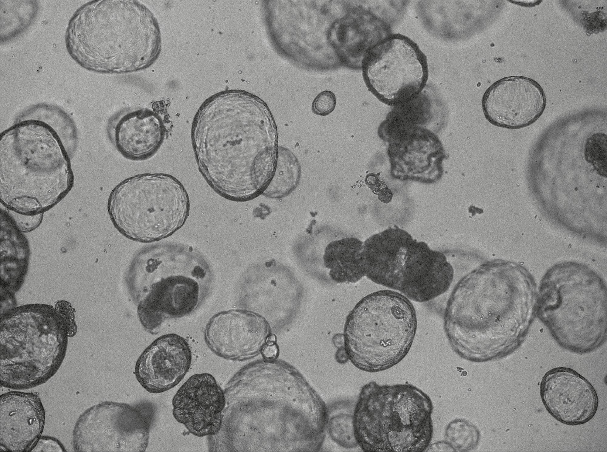 Tissue-specific mutation accumulation in human adult stem cells during life