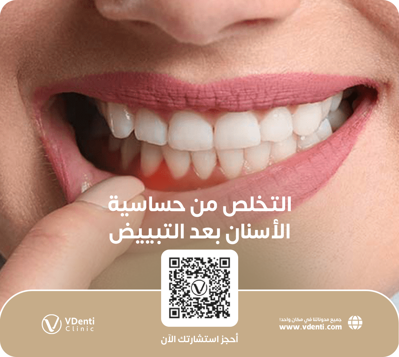 التخلص من حساسية الأسنان بعد التبييض