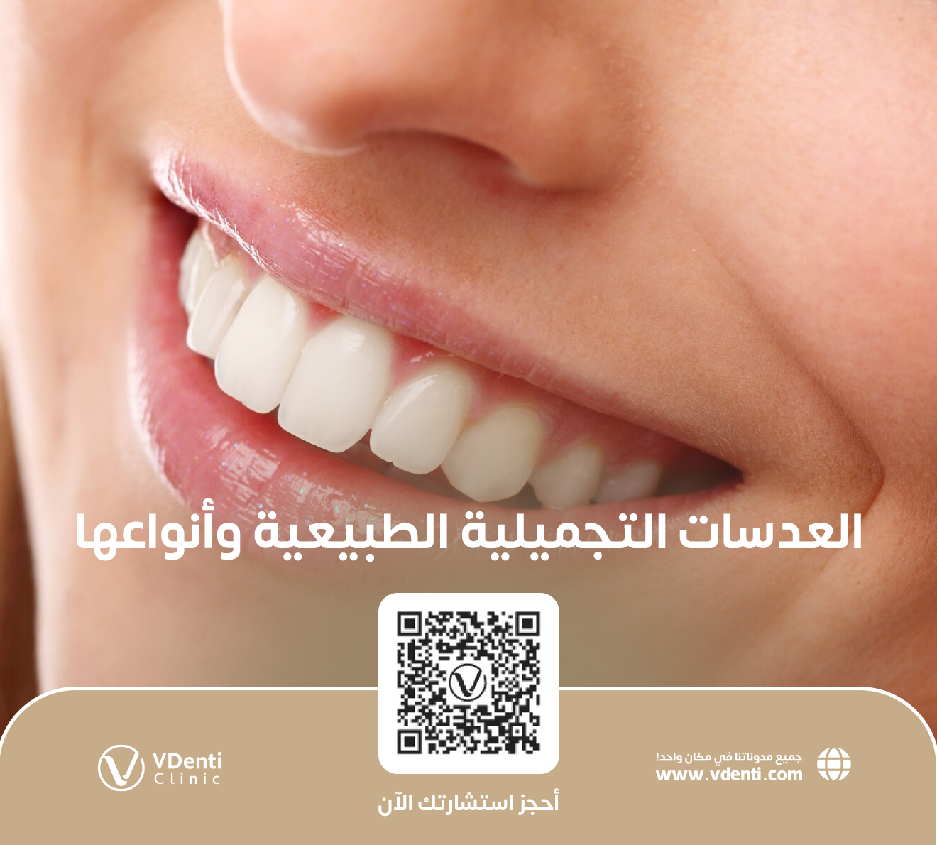 العدسات التجميلية للاسنان 2000_653b43bd6faec