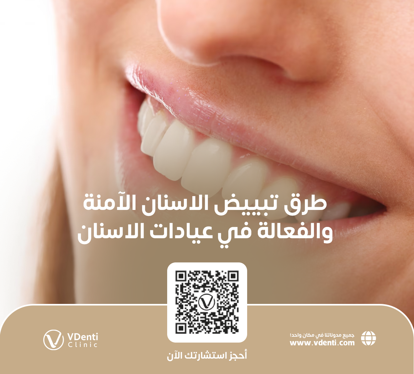 طرق تبييض الاسنان الآمنة والفعالة في عيادات الاسنان بجدة
