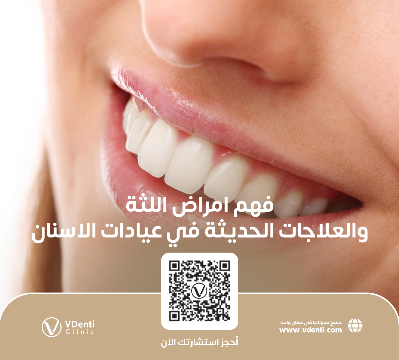 دليل شامل لفهم امراض اللثة والعلاجات الحديثة في عيادات الاسنان بجدة