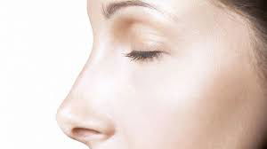 La rhinoplastie médicale