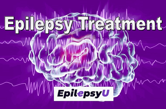 Treatment of Epilepsy