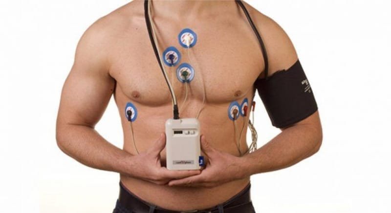 Holter - Eletrocardiografia Dinâmica de 24 horas – Biocor