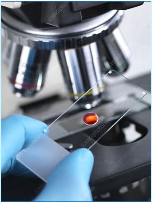 Morphological Blood Analysis