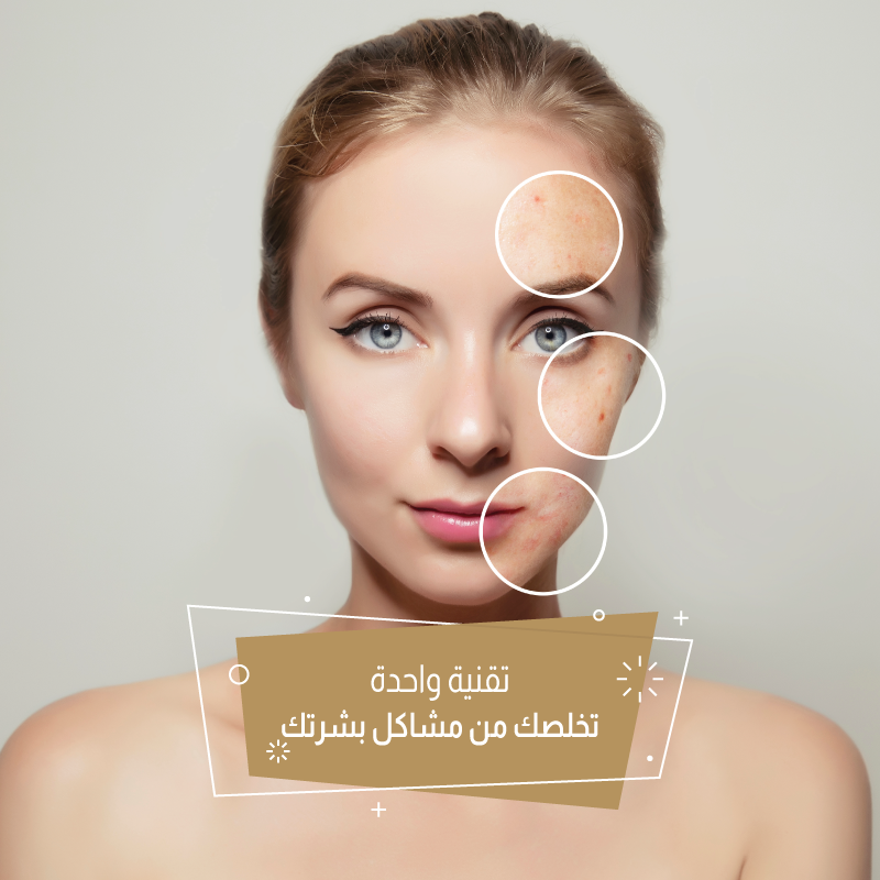 جلستين فراكشنال "eCo2"