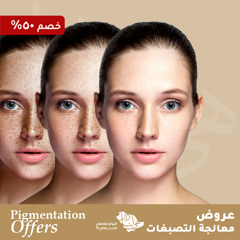 حقن الترانيكساميك أسيد " 1 مل "