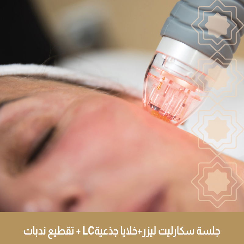 جلسة سكارليت + خلايا جذعية + تقطيع ندبات