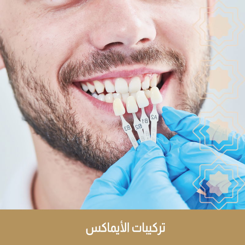 تركيبات الإيماكس " فك واحد "