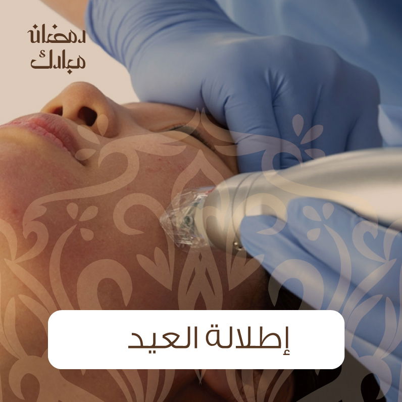 سكارليت ليزر +ميزو ( هيلرونيك ، تفتيح ، خلايا جذعية)