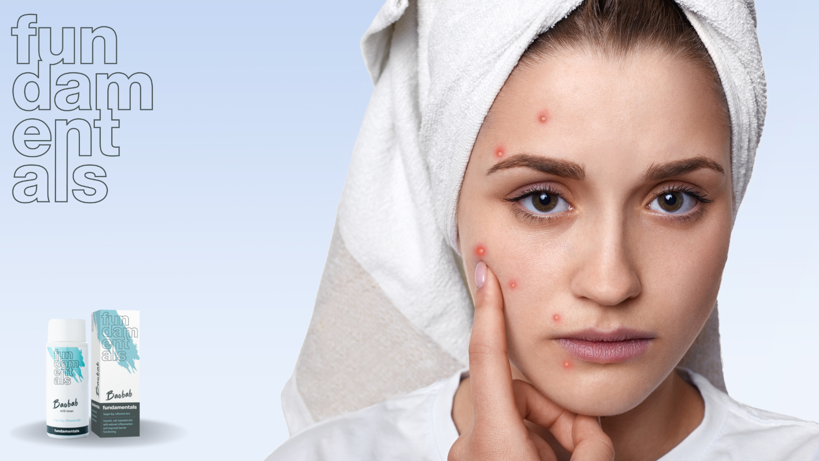 Acne awareness – types, appearance, marks and treatment
