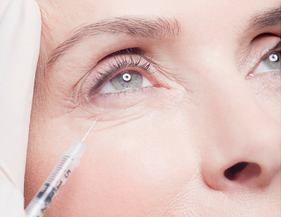 Tratamientos de Ojeras