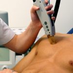 Depilación Definitiva Masculina