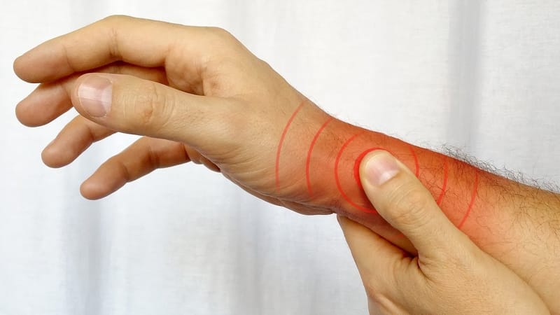 Sindromul De Quervain/Rupturi de tendon