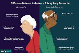 What is the difference between Dementia in Women and Dementia in men?