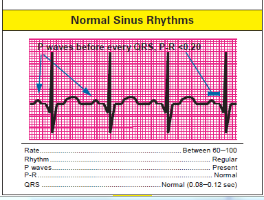 ECG Heart Scan