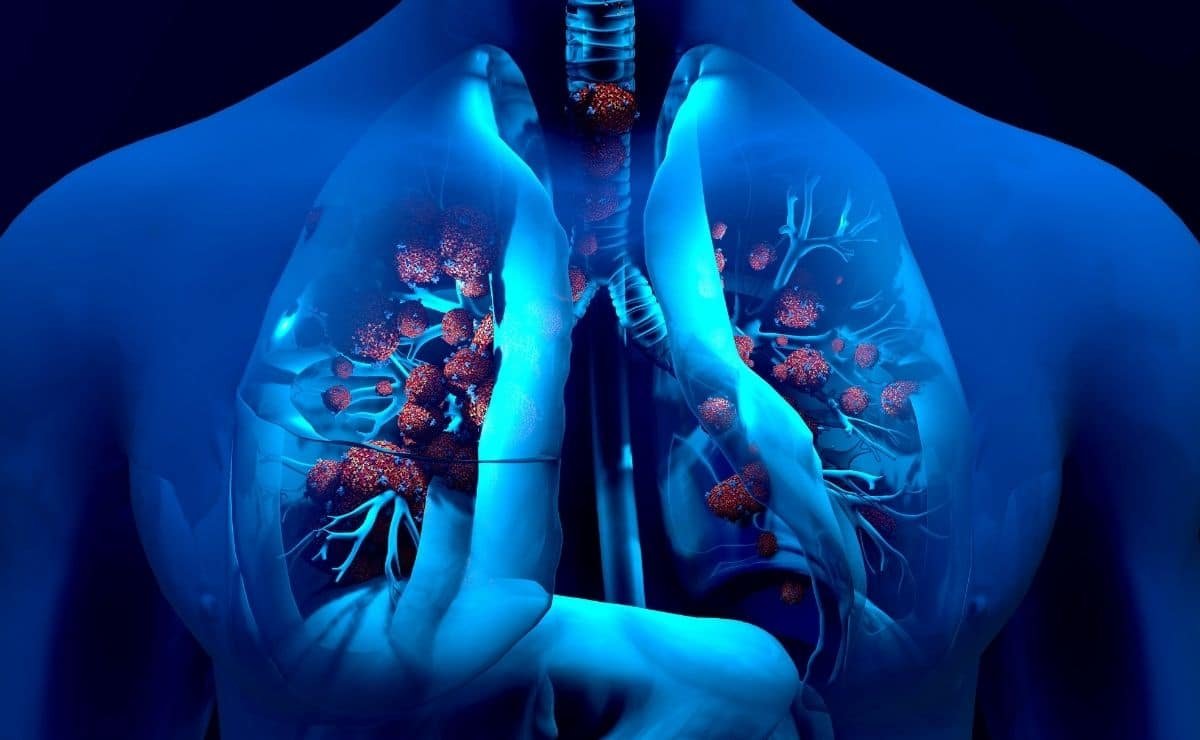 La vía respiratoria y la respiración durante la anestesia
