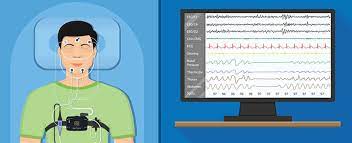 Polysomnography (Sleep study) - JP Clinical Neurophysiologists