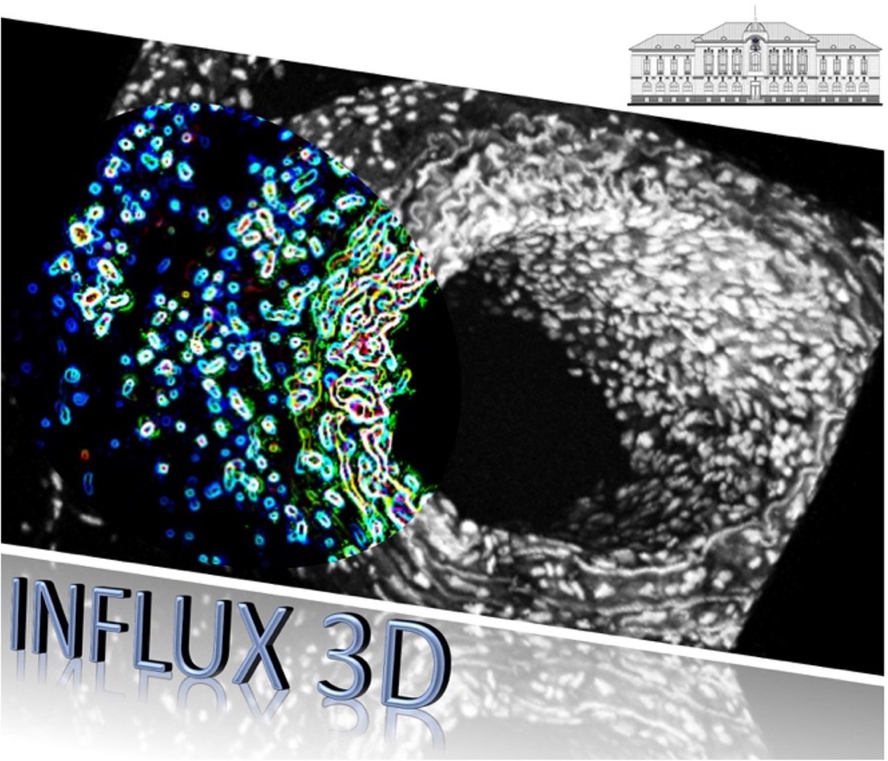 Investigation of Tissular Extracellular Matrix by Automatised 3D Tissue Reconstruction