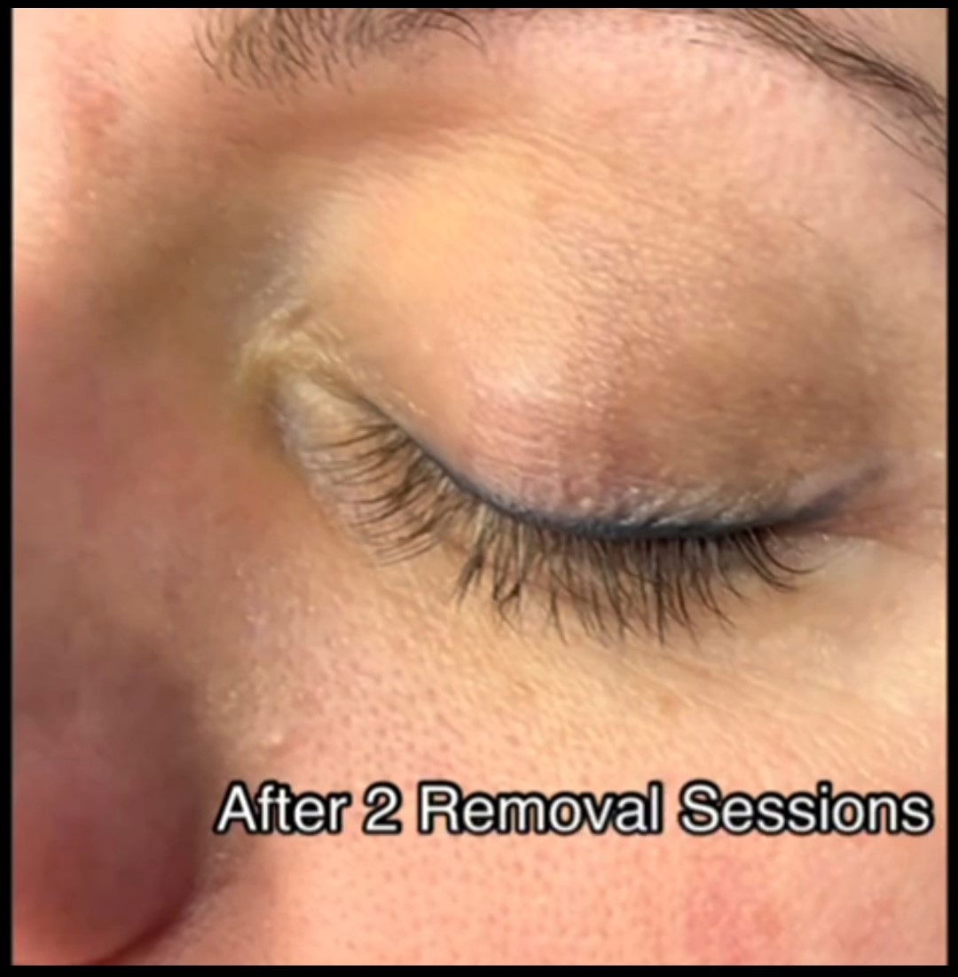 Permanent Eyeliner (wing)