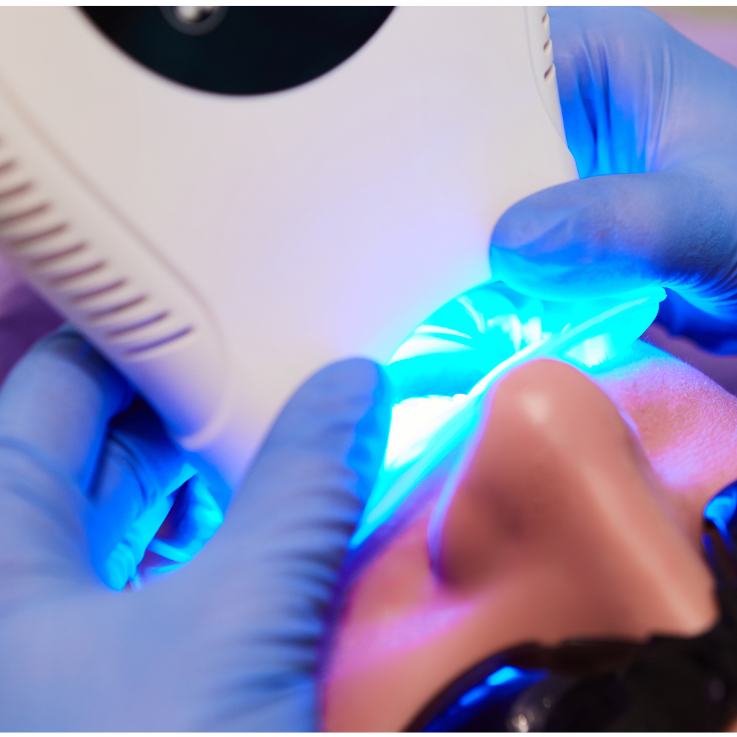 Cosmetic LED Teeth Whitening