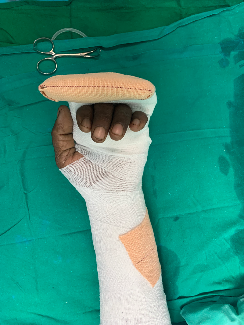 Dressings in Surgery SLAPRAS