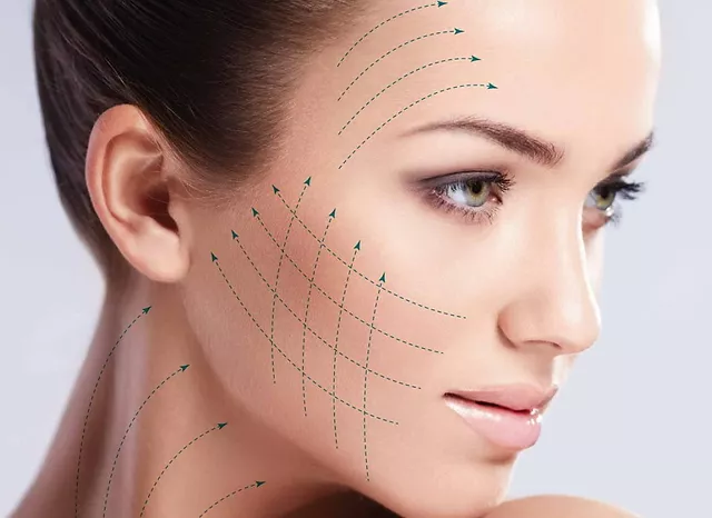 Vmax 7D HIFU Treatment in Limassol: Non-Surgical Skin Tightening