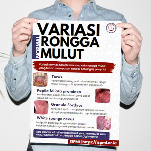 Poster Variasi Normal Rongga Mulut Ispmi Ispmi Ikatan Spesialis