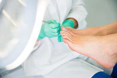 How to Remove Dry Skin on Feet - Doncaster Foot Clinic