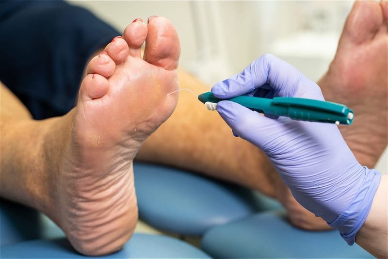 The Diabetic foot