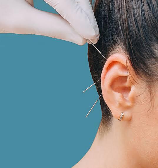 Ear Acupuncture, Depression, anxiety, substance abuse, additions