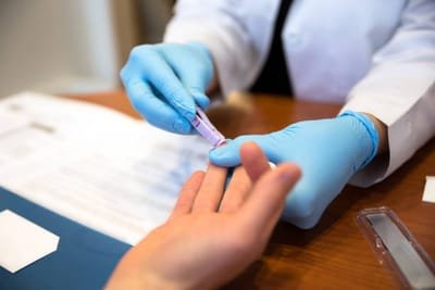 How to Get an Professional HIV Test image