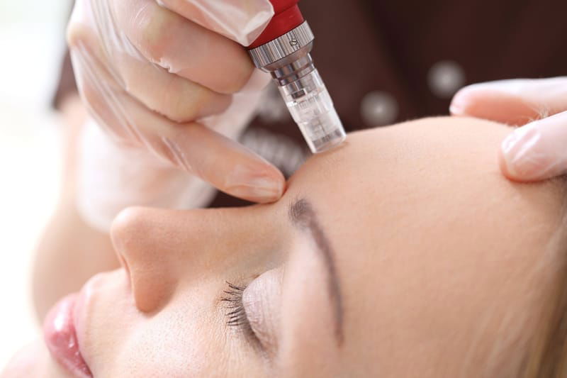 Microneedling & Dermapen Facials